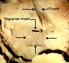 Post Hole